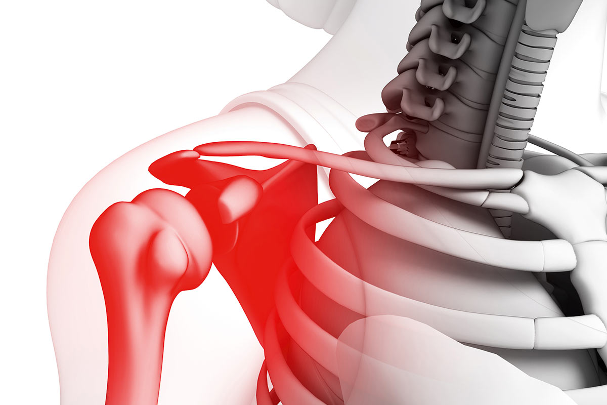 Deformirajući osteoartritis zglobova stopala: uzroci, značajke i metode liječenja - Išijas 